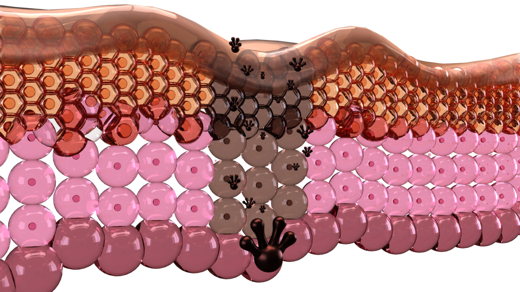 illustration of the layers of skin depicting hyperpigmentation or unwanted pigment.