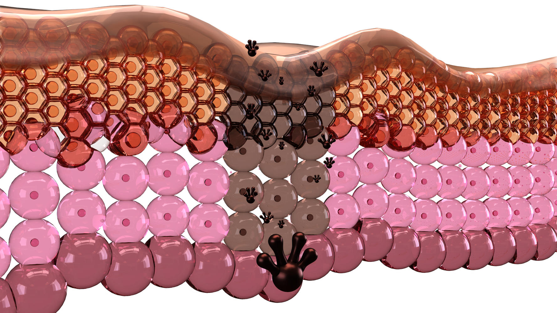 illustration of the layers of skin depicting hyperpigmentation or unwanted pigment.