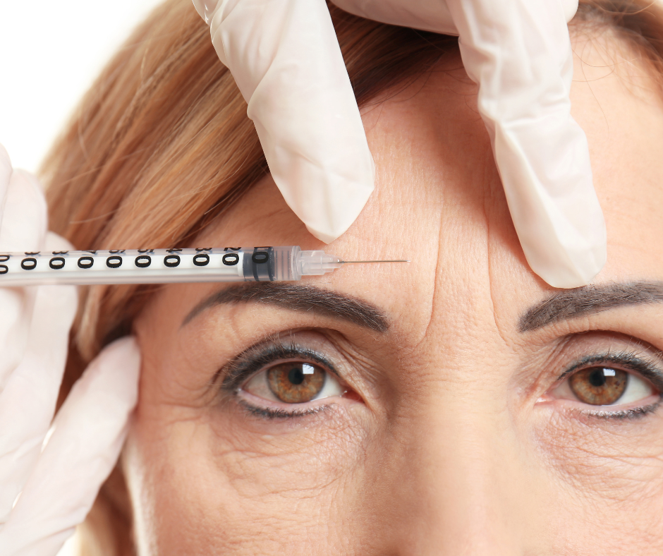 close up of forehead wrinkles known as 11's. A medical professional holds a syringe to the wrinkles.