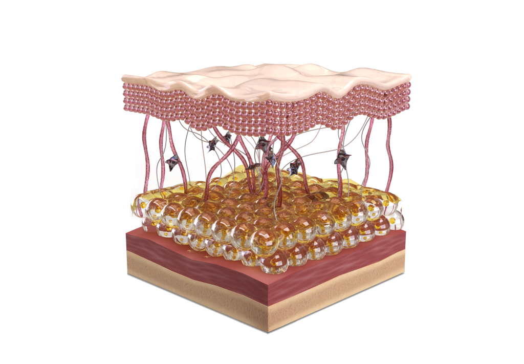 illustration of aged skin. Shows the layers of the skin and connections between them.