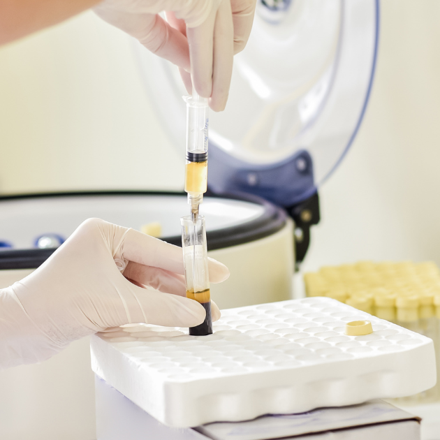 a nurse extracts prp serum from vial.