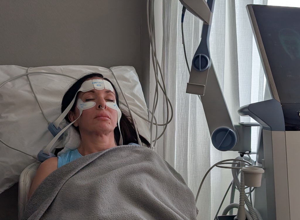 a patient receives Emface treatment at Melinda Menezes MD